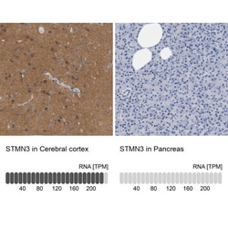 STMN3 Antibody, Novus Biologicals 25ul | Buy Online | Novus Biologicals | Fisher Scientific